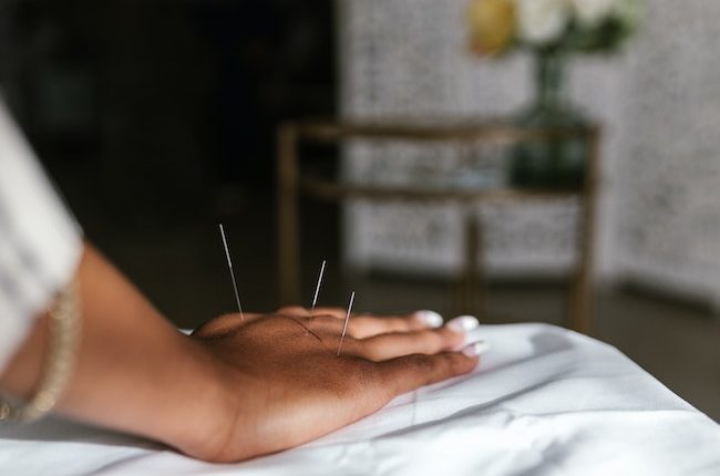 acupuncture - pain management - non-addictive pain management - pain pills