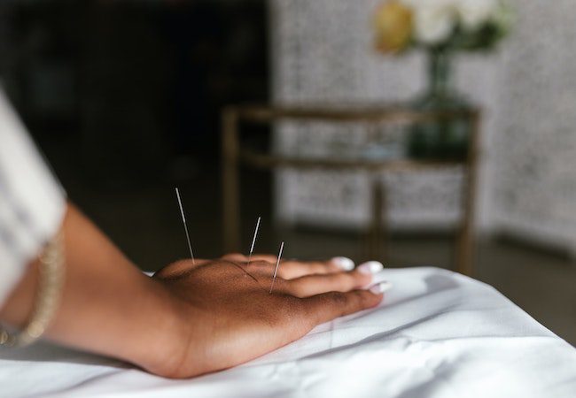 acupuncture - pain management - non-addictive pain management - pain pills